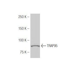 TRAP95 Antibody (F83) - Western Blotting - Image 54004 