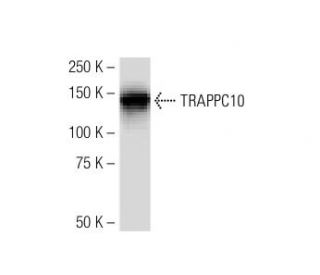 TRAPPC10 Antibody (RR-18) - Western Blotting - Image 34618