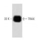TRAX Antibody (56) - Western Blotting - Image 60478