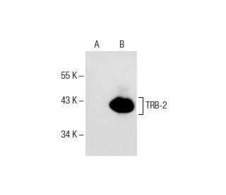 TRB-2 Antibody (B-06) - Western Blotting - Image 153869