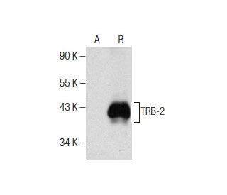 TRB-2 Antibody (F-5) - Western Blotting - Image 159011