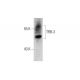 TRB-3 Antibody (E-7) - Western Blotting - Image 324773 