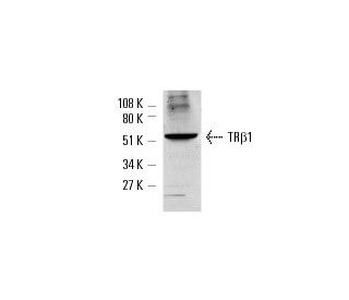 TR&beta;1 Antibody (J52) - Western Blotting - Image 1665 