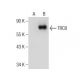 TRC8 Antibody (E-12) - Western Blotting - Image 155328