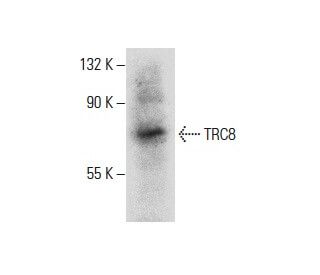 TRC8 Antibody (H-9) - Western Blotting - Image 288002SAM Transcription Activation: SAM system utilizing dCas9-VP64, MS2-P65-HSF1, and sgRNA for precise gene transcription activation.