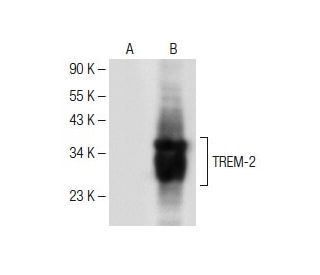 TREM-2 Antibody (B-3) - Western Blotting - Image 150585 