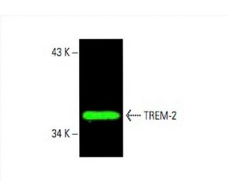 TREM-2 Antibody (B-3) - Western Blotting - Image 392410The Double Nickase Plasmid features a U6 promoter for sgRNA expression, a 20 nt targeting sequence, and a gRNA scaffold to guide Cas9n. It includes a CBh promoter for Cas9n (D10A) and puromycin resistance, GFP for transfection verification, and nuclear localization signals (NLS). The 2A peptide allows co-expression of Cas9n and Puro from a single promoter, enabling precise genome editing with reduced off-target effects.