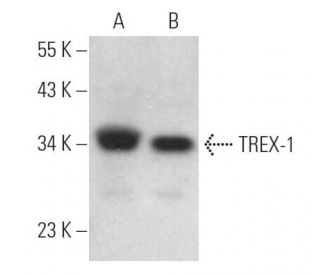 TREX-1 Antibody (E-6) - Western Blotting - Image 371521 