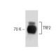 TRF2 Antibody (36) - Western Blotting - Image 60480 