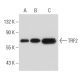 TRF2 Antibody (4A794) - Western Blotting - Image 52354