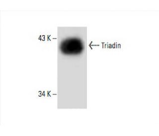 Triadin Antibody (IIG12) - Western Blotting - Image 394095Each CRISPR/Cas9 Knockout (KO) Plasmid product consists of a pool of 3 plasmids designed to ensure identification and cleavage of a specific gene for maximum knockout efficiency. Each plasmid encodes a unique 20 nt sequence derived from the GeCKO (v2) library.