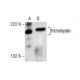 Trichohyalin Antibody (E-11) - Western Blotting - Image 157828