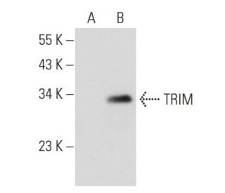 TRIM Antibody (TRIM-04) - Western Blotting - Image 52365