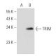 TRIM Antibody (TRIM-04) - Western Blotting - Image 52365