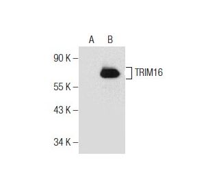 TRIM16 Antibody (5-RY8) - Western Blotting - Image 155368 