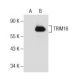 TRIM16 Antibody (5-RY8) - Western Blotting - Image 155368 
