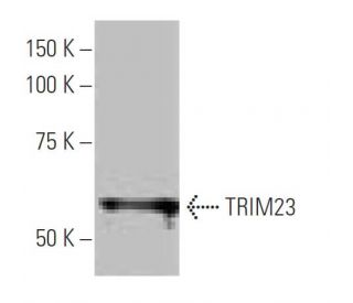 TRIM23 Antibody (8H9) - Western Blotting - Image 65080
