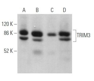 TRIM3 Antibody (27) - Western Blotting - Image 367119 