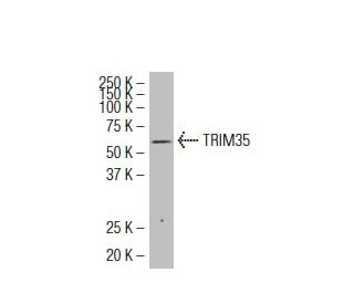 TRIM35 Antibody (31-M) - Western Blotting - Image 34252SAM Transcription Activation: SAM system utilizing dCas9-VP64, MS2-P65-HSF1, and sgRNA for precise gene transcription activation.