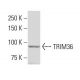 TRIM36 Antibody (SS-03) - Western Blotting - Image 34253 