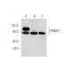 TRIM37 Antibody (C-6) - Western Blotting - Image 333753 