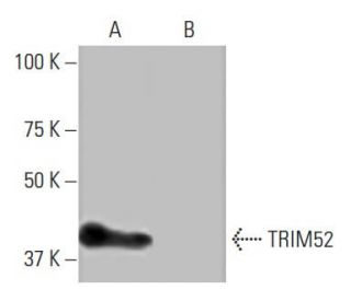 TRIM52 Antibody (3-YD23) - Western Blotting - Image 65082