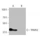 TRIM52 Antibody (3-YD23) - Western Blotting - Image 65082