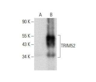 TRIM52 Antibody (A-4) - Western Blotting - Image 309506