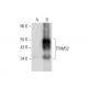 TRIM52 Antibody (A-4) - Western Blotting - Image 309506