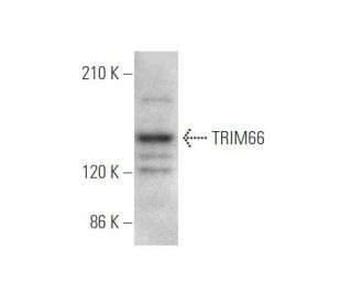 TRIM66 Antibody (A-9) - Western Blotting - Image 349039 