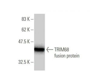 TRIM68 Antibody (5G2) - Western Blotting - Image 349590