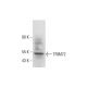 TRIM72 Antibody (A-10) - Western Blotting - Image 325207