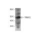 TRIM72 Antibody (A-10) - Western Blotting - Image 351837 