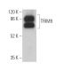 TRIM9 Antibody (D-11) - Western Blotting - Image 372380