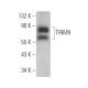 TRIM9 Antibody (G-4) - Western Blotting - Image 372552