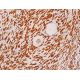 Trimethyl Histone H4 Antibody (6F8-D9) - Immunohistochemistry - Image 411566 