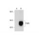 TRIP6 Antibody (C-5) - Western Blotting - Image 72482