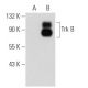 TrkB Antibody (G-11) - Western Blotting - Image 52181