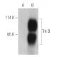 TrkB Antibody (H--8) - Western Blotting - Image 399044 