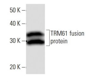TRM61 Antibody (C145I165) - Western Blotting - Image 16823
