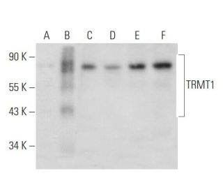 TRMT1 Antibody (F-8) - Western Blotting - Image 333453 