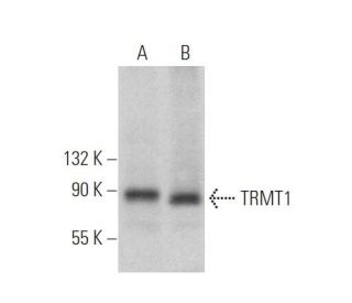 TRMT1 Antibody (F-8) - Western Blotting - Image 372417