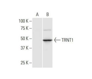 TRNT1 Antibody (1G11) - Western Blotting - Image 352190 