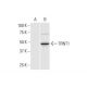 TRNT1 Antibody (1G11) - Western Blotting - Image 352190 