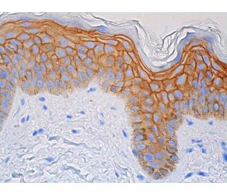 TROP-2 Antibody (B-9) - Immunohistochemistry - Image 391618 