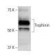 Trophinin Antibody (clone 3-11) - Western Blotting - Image 137493