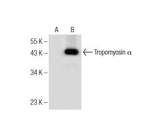 Tropomyosin &alpha; Antibody (F-6) - Western Blotting - Image 155832 