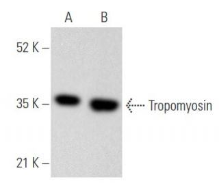 Tropomyosin Antibody (C-3) - Western Blotting - Image 355488 