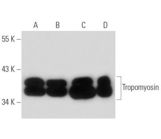 Tropomyosin Antibody (CH1) - Western Blotting - Image 15580 