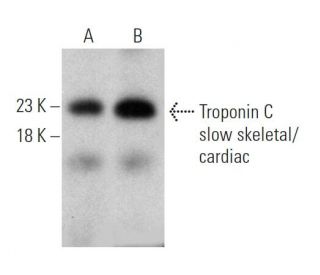 Troponin C slow skeletal/cardiac Antibody (7B9) - Western Blotting - Image 366691Each CRISPR/Cas9 Knockout (KO) Plasmid product consists of a pool of 3 plasmids designed to ensure identification and cleavage of a specific gene for maximum knockout efficiency. Each plasmid encodes a unique 20 nt sequence derived from the GeCKO (v2) library.